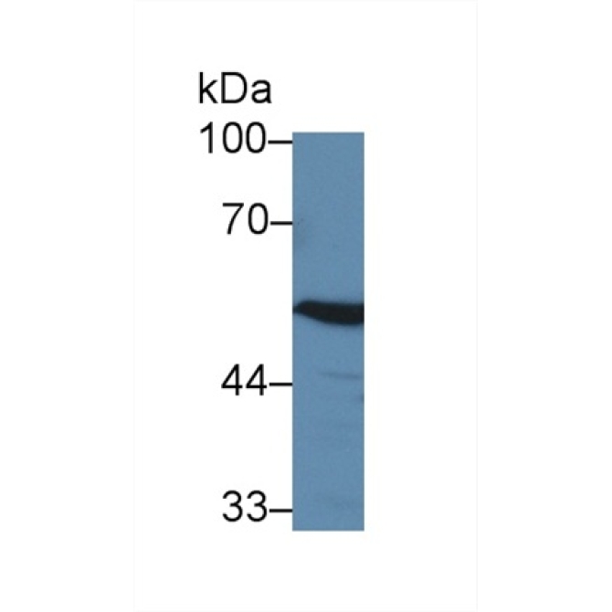 4-Aminobutyrate Aminotransferase (ABAT) Human Polyclonal Antibody