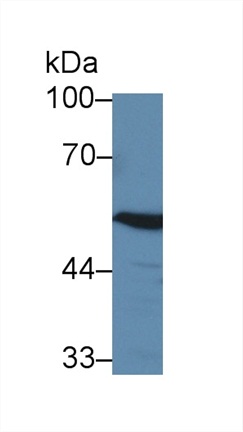 4-Aminobutyrate Aminotransferase (ABAT) Human Polyclonal Antibody