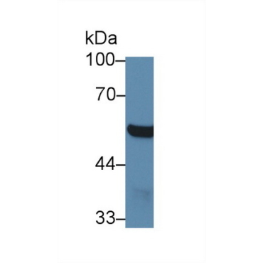 4-Aminobutyrate Aminotransferase (ABAT) Mouse Polyclonal Antibody