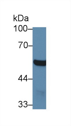 4-Aminobutyrate Aminotransferase (ABAT) Mouse Polyclonal Antibody