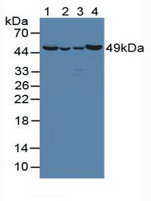 Ornithine Aminotransferase (OAT) Human Polyclonal Antibody