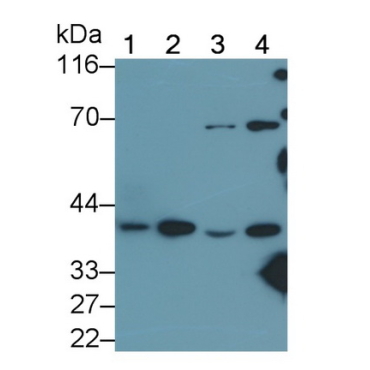 Phosphoserine Aminotransferase 1 (PSAT1) Human Polyclonal Antibody