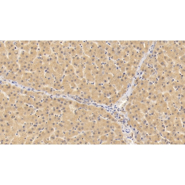 Glutamine Fructose-6-Phosphate Transaminase 1 (GFPT1) Human Polyclonal Antibody