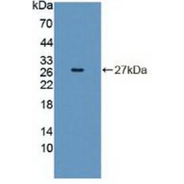 Insulin Receptor Related Receptor (INSRR) Human Polyclonal Antibody