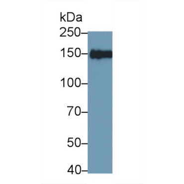 Insulin Receptor Substrate 2 (IRS2) Human Polyclonal Antibody