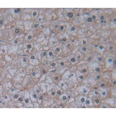 Insulin Receptor Substrate 4 (IRS4) Human Polyclonal Antibody