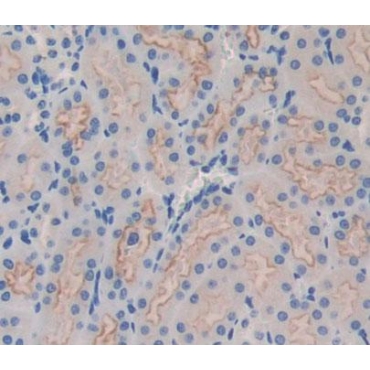 Insulin Receptor Substrate 4 (IRS4) Mouse Polyclonal Antibody