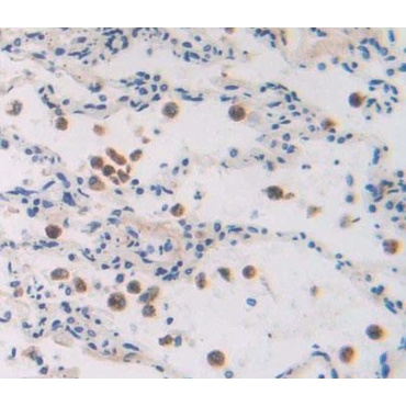 General Transcription Factor IIA, Polypeptide 2 (GTF2A2) Human Polyclonal Antibody