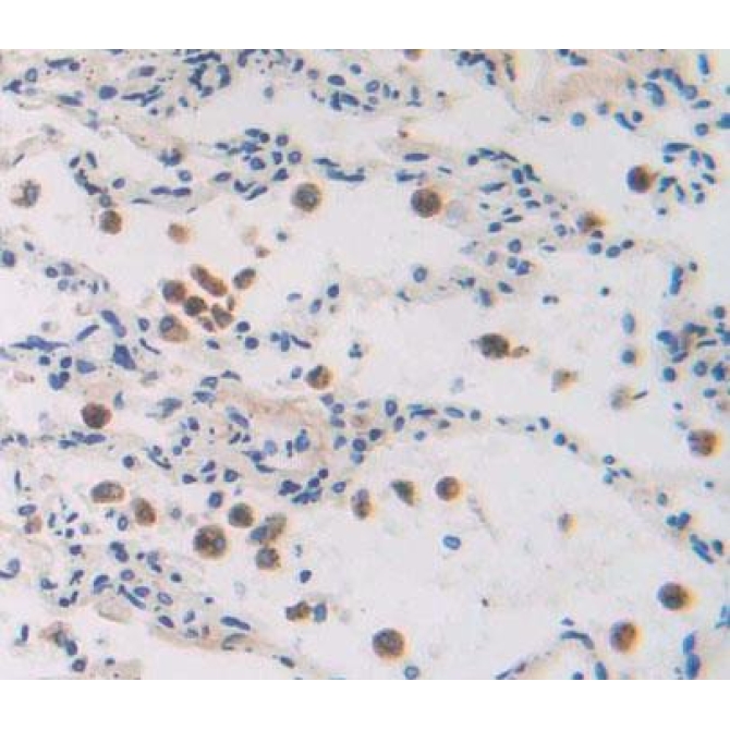 General Transcription Factor IIA, Polypeptide 2 (GTF2A2) Human Polyclonal Antibody