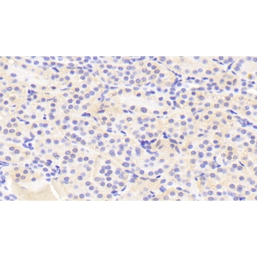 General Transcription Factor IIH, Polypeptide 5 (GTF2H5) Human Polyclonal Antibody