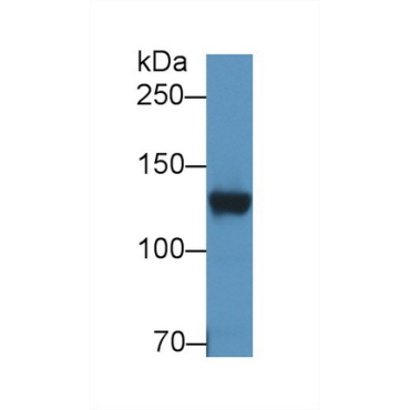 Dipeptidyl Peptidase 6 (DPP6) Human Polyclonal Antibody