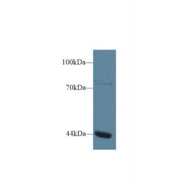 General Transcription Factor IIIA (GTF3A) Human Polyclonal Antibody