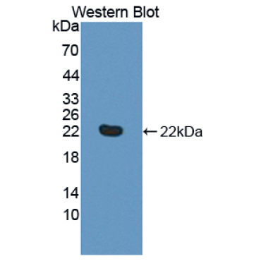 Tumor Necrosis Factor Receptor Superfamily, Member 14 (TNFRSF14) Human Polyclonal Antibody