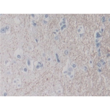 Dipeptidyl Peptidase 8 (DPP8) Human Polyclonal Antibody