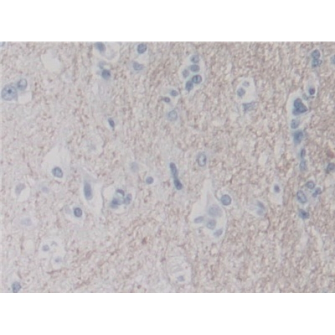 Dipeptidyl Peptidase 8 (DPP8) Human Polyclonal Antibody