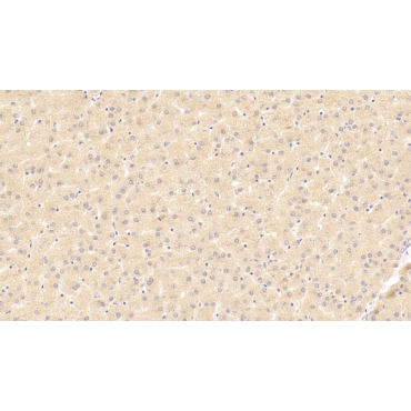 Tumor Necrosis Factor Receptor Superfamily, Member 19 (TNFRSF19) Human Polyclonal Antibody