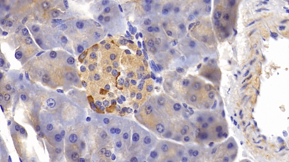Tumor Necrosis Factor Receptor Superfamily, Member 21 (TNFRSF21) Mouse Polyclonal Antibody