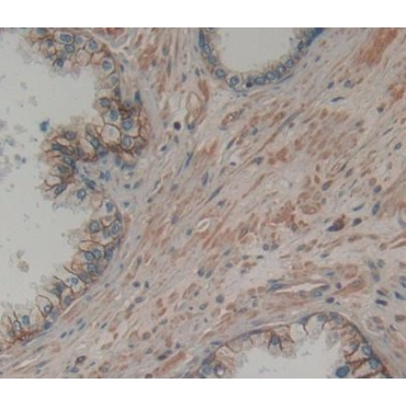 Tumor Necrosis Factor Receptor Superfamily, Member 25 (TNFRSF25) Human Polyclonal Antibody
