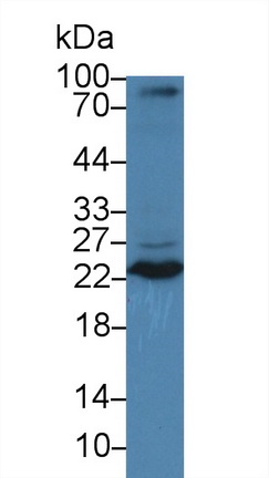 Tumor Necrosis Factor Ligand Superfamily, Member 12 (TNFSF12) Mouse Polyclonal Antibody