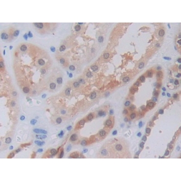 Tumor Necrosis Factor Ligand Superfamily, Member 9 (TNFSF9) Human Polyclonal Antibody