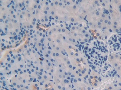 Tumor Necrosis Factor Ligand Superfamily, Member 9 (TNFSF9) Mouse Polyclonal Antibody