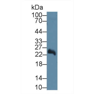 5'-Nucleotidase, Mitochondrial (NT5M) Human Polyclonal Antibody