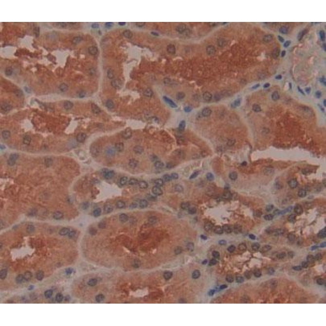 3',5'-Bisphosphate Nucleotidase 1 (BPNT1) Human Polyclonal Antibody