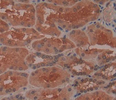 3',5'-Bisphosphate Nucleotidase 1 (BPNT1) Human Polyclonal Antibody