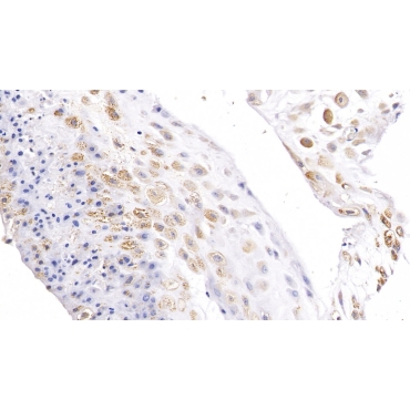 5'-Nucleotidase, Cytosolic II (NT5C2) Human Polyclonal Antibody