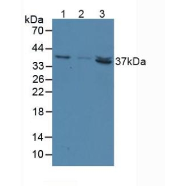 5'-Nucleotidase, Cytosolic III (NT5C3) Human Polyclonal Antibody