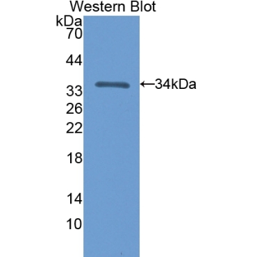 5'-Nucleotidase, Cytosolic III (NT5C3) Mouse Polyclonal Antibody