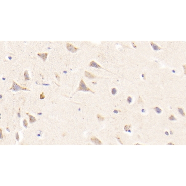 Nuclear Receptor Subfamily 1, Group D, Member 1 (NR1D1) Human Polyclonal Antibody