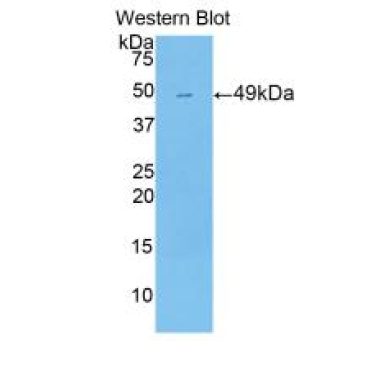 Pregnane X Receptor (PXR) Mouse Polyclonal Antibody