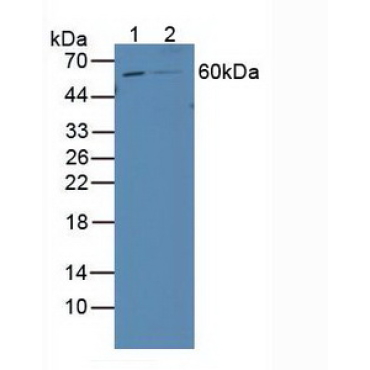 Retinoic Acid Receptor Beta (RARb) Human Polyclonal Antibody