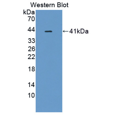 Nuclear Receptor Related Protein 1 (NURR1) Human Polyclonal Antibody