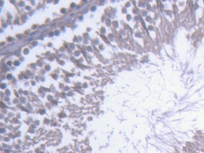Nuclear Receptor Subfamily 0, Group B, Member 1 (NR0B1) Rat Polyclonal Antibody