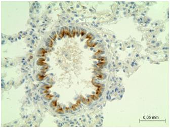 Adrenergic Receptor Beta 2 (ADRb2) Rat Polyclonal Antibody