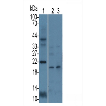Calcyon Neuron Specific Vesicular Protein (CALY) Human Polyclonal Antibody