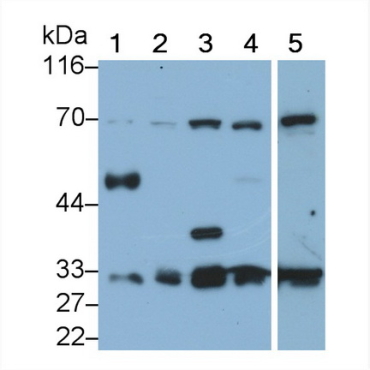 Dimethylarginine Dimethylaminohydrolase 2 (DDAH2) Human Polyclonal Antibody