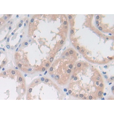 Dimethylarginine Dimethylaminohydrolase 1 (DDAH1) Human Polyclonal Antibody