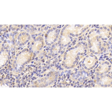 Cathepsin O (CTSO) Human Polyclonal Antibody