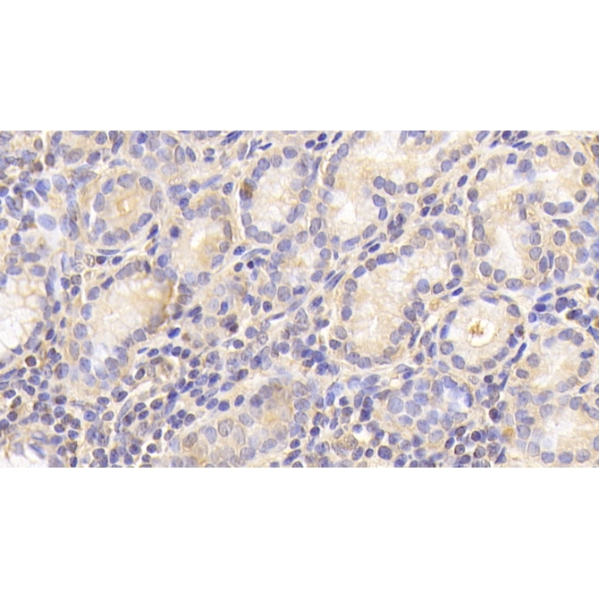 Cathepsin O (CTSO) Human Polyclonal Antibody