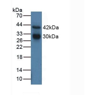 Cathepsin G (CTSG) Human Polyclonal Antibody