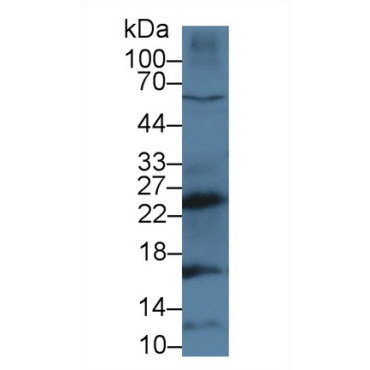 Cathepsin G (CTSG) Mouse Polyclonal Antibody