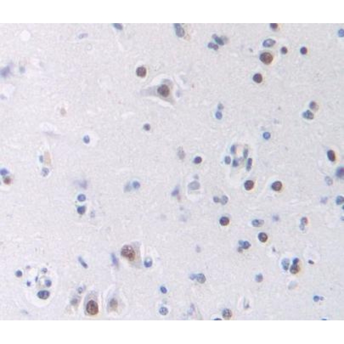 Cyclic AMP Response Element Binding Protein 5 (CREB5) Human Polyclonal Antibody
