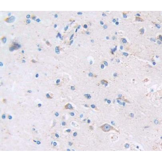 Calcium Binding Protein 1 (CABP1) Human Polyclonal Antibody