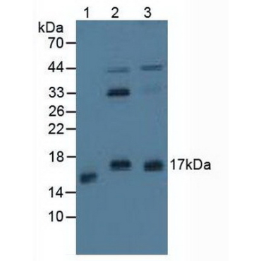 Protein Phosphatase 3, Regulatory Subunit 1 (PPP3R1) Human Polyclonal Antibody