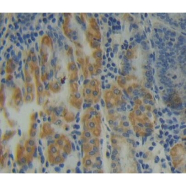 Protein Phosphatase 6, Catalytic Subunit (PPP6C) Human Polyclonal Antibody