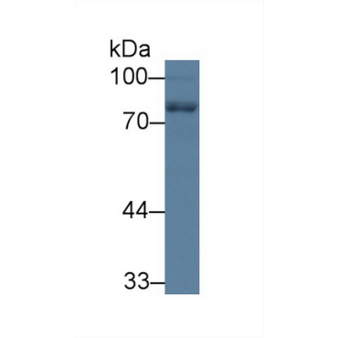 Neurofilament, Light Polypeptide (NEFL) Human Polyclonal Antibody