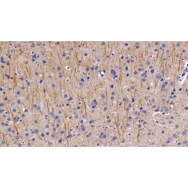 Neurofilament, Light Polypeptide (NEFL) Human Polyclonal Antibody